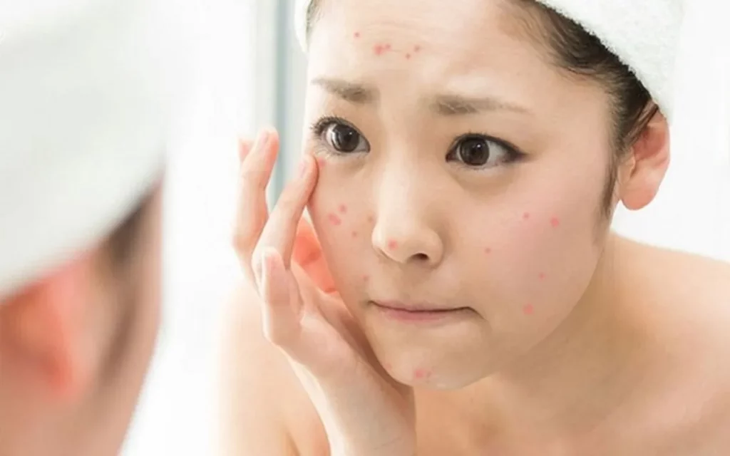 Lựa Chọn Sản Phẩm Dưỡng Ẩm Phù Hợp Cho Da Khô